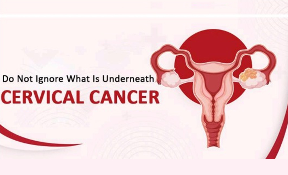 Do Not Ignore What Is Underneath: Cervical Cancer