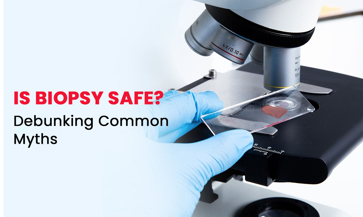 Is Biopsy Safe? Debunking Common Myths